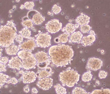 Image of measles virus strains that infect and kill glioma stem cells