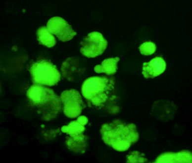 Image of a virus strain coding for MV-GFP that helped visualize infected cells