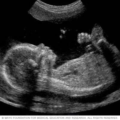 显示胎儿面部的胎儿超声幻灯片 