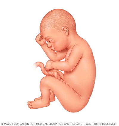 Fetus 31 weeks after conception 