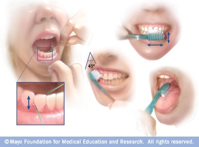 Flossing vs Brushing- Global Estetik Dental Care