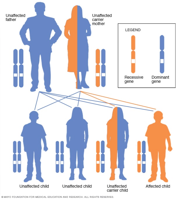 Patrón hereditario vinculado al cromosoma X con una madre portadora