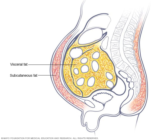 Ilustración de los lugares en donde se acumula la grasa abdominal