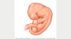 Embryo five weeks after conception 