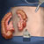 min-invasive-surgery-thsm.jpg