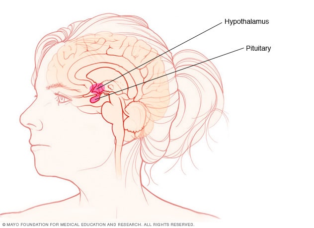 What symptoms are associated with a neoplasm?