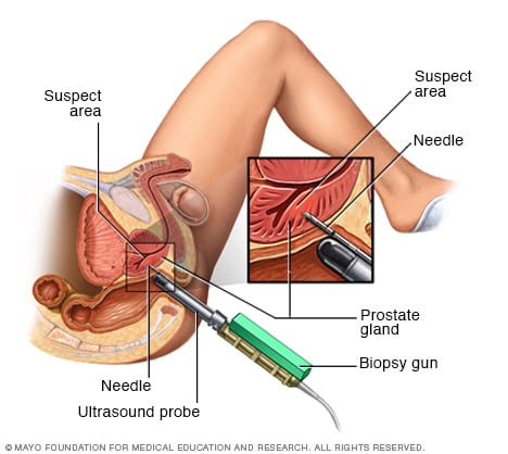 Sperm count instrument