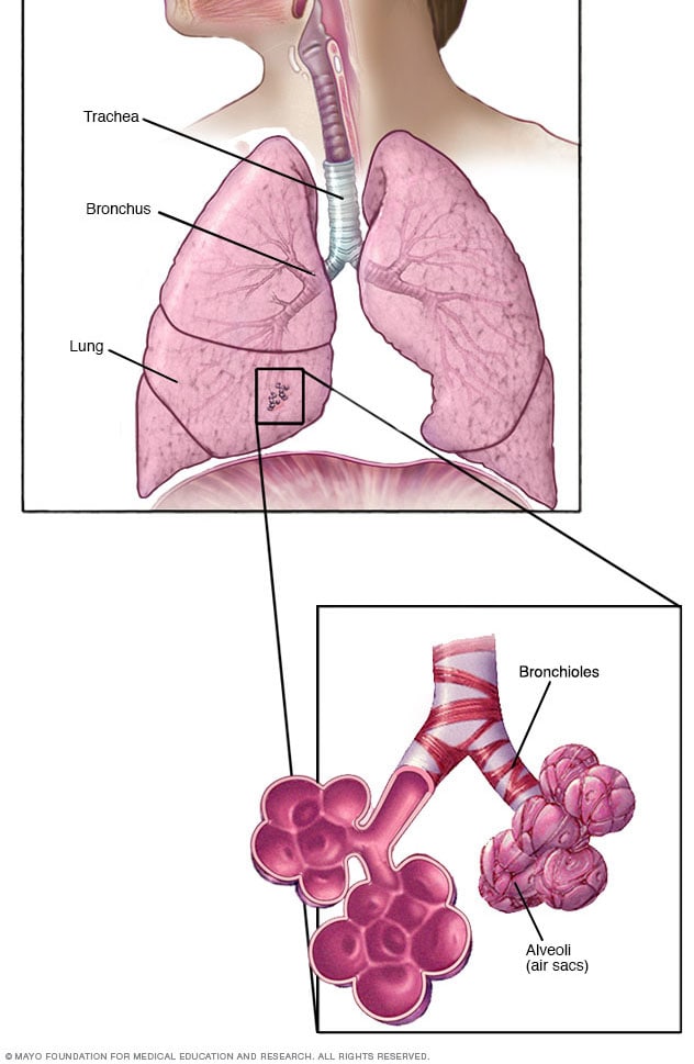 Bronquiolos y alvéolos en los pulmones