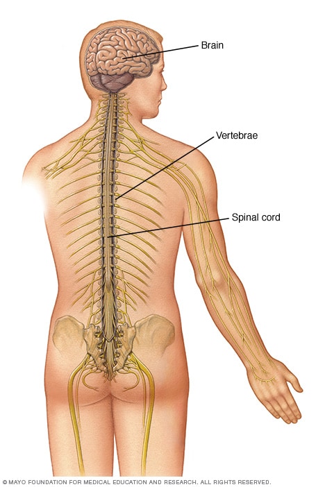 What is spine cancer called?