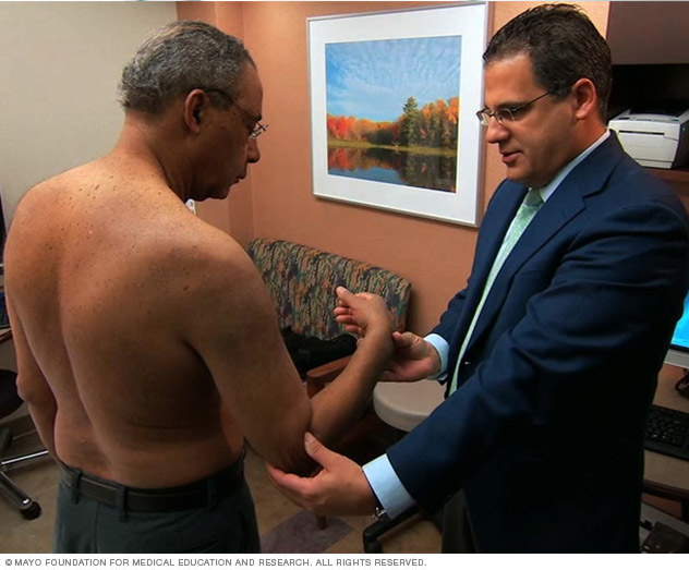 Rotator cuff injury Symptoms and causes Mayo Clinic