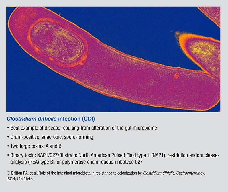 FMT demonstrates consistently high success rates for recurrent CDI