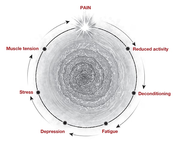 Graphic of POTS-associated pain and fatigue symptoms