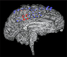 Implant location indicated by dots