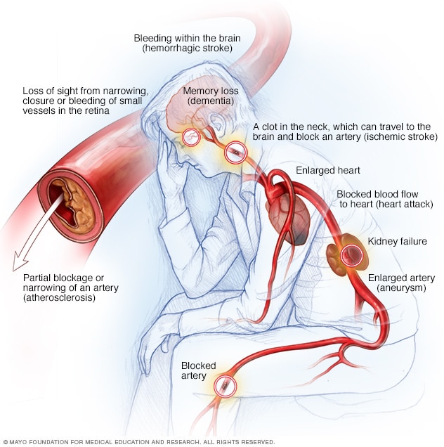 What does it mean when you have abnormal blood pressure?