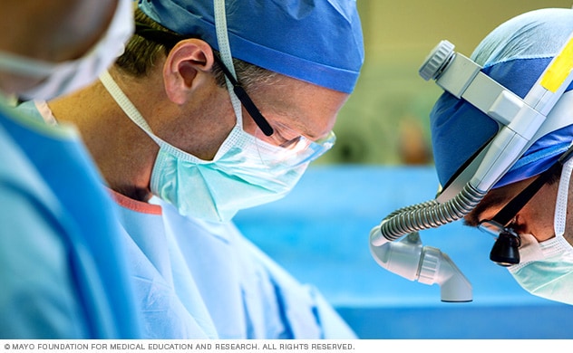 妙佑医疗国际的泌尿外科医生在施行部分肾切除术。