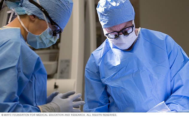 Cirugía para tratar el neurinoma del acústico en Mayo Clinic
