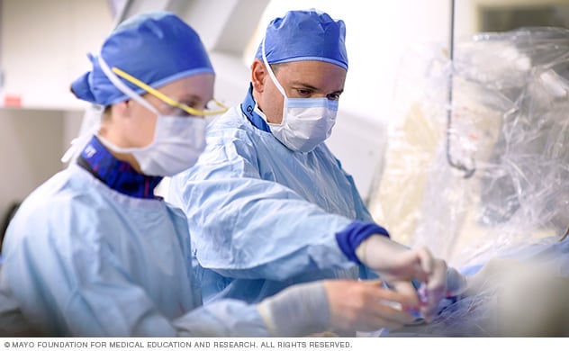 Los médicos de Mayo Clinic colocan stents para la enfermedad de las arterias carótidas.