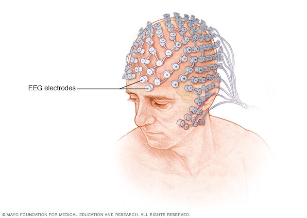 高密度 EEG 检测中的电极位置