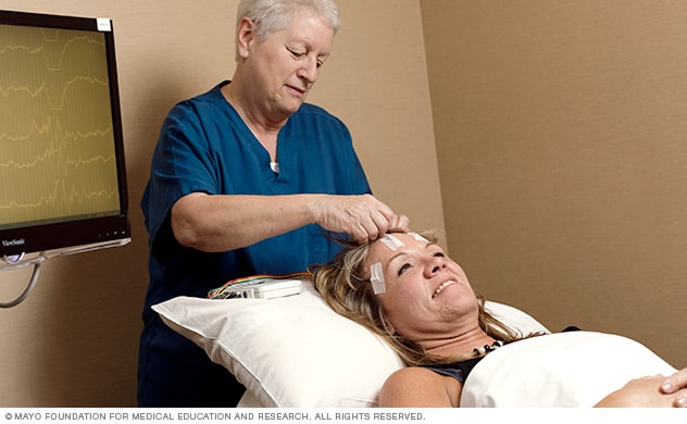 Se aplican electrodos al cuero cabelludo antes del electroencefalograma