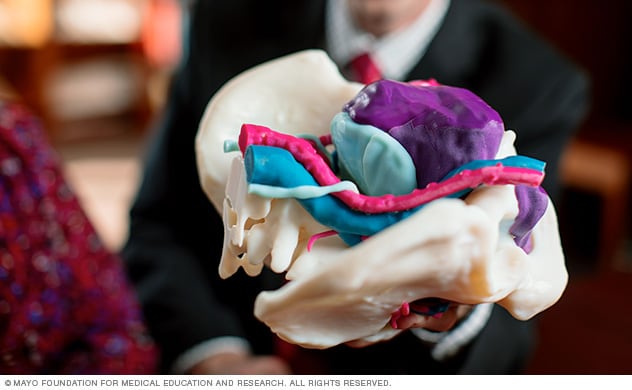 Colorful 3D model of tumor in pelvis