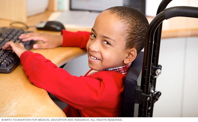 Child in a wheelchair typing at a computer