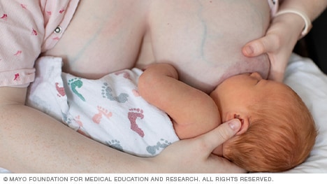 Woman breastfeeding with cross-cradle hold
