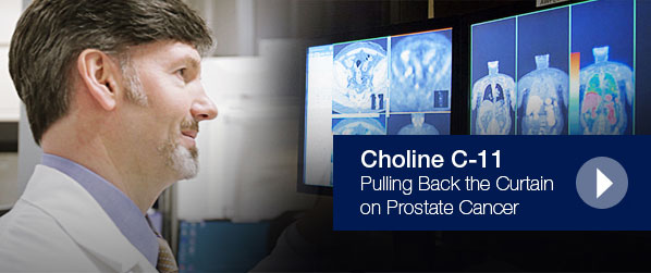 Choline C-11 - Pulling Back the Curtain on Prostate Cancer