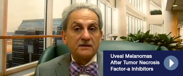 Uveal Melanomas After Tumor Necrosis Factor-a Inhibitors