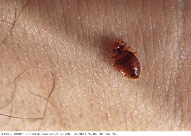 Image of a bedbug 
