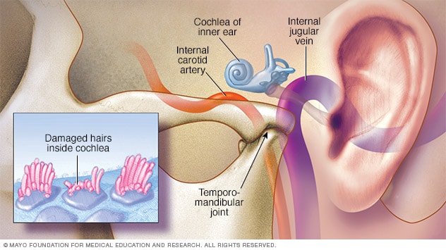 Inside of ear and damaged hairs 