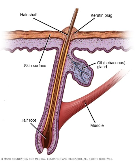 Illustration showing the keratin plug 
