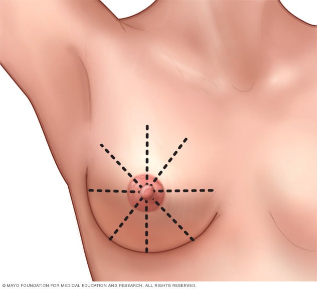 Illustration showing wedge-shaped pattern for breast self-exam