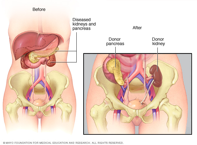 Medical Definition of Senile lentigo - MedicineNet