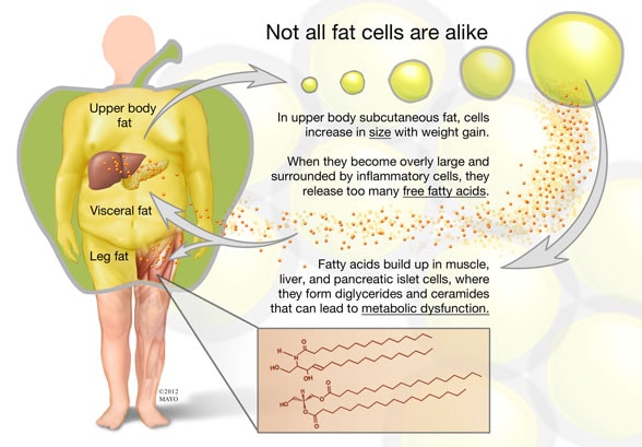 Image depicting upper body fat cell function and effect