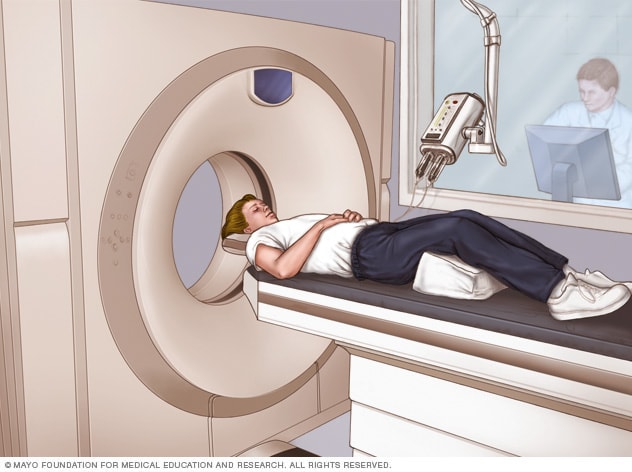 CT scan illustration