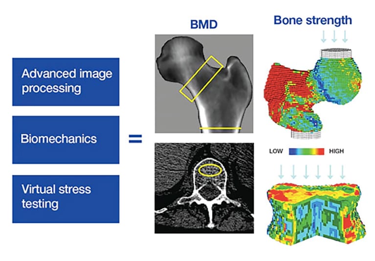 Assessment of bone strength in vivo in humans: A novel diagnostic tool for  osteoporosis - Mayo Clinic