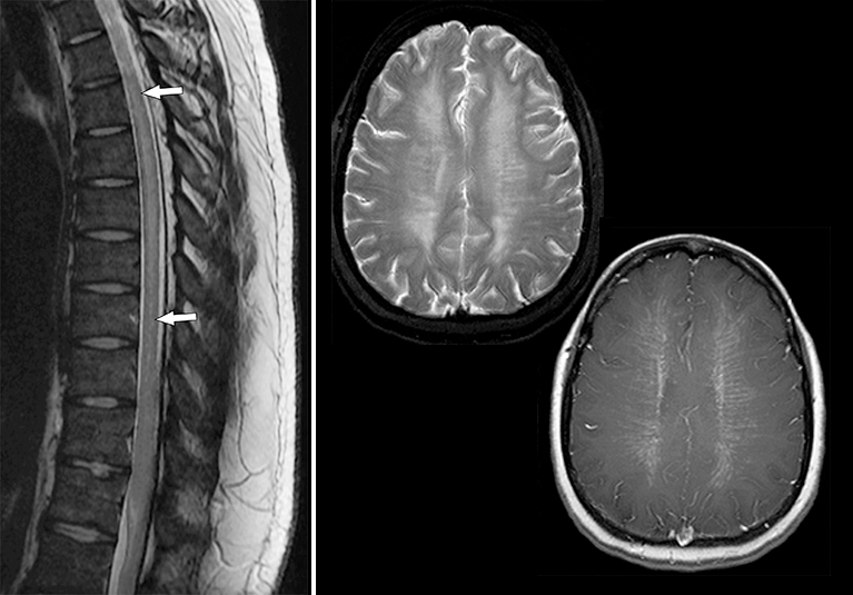 Neurosciences News Medical Professionals Mayo Clinic
