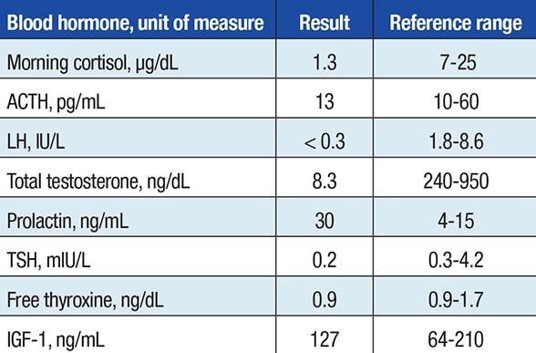 Hormonal evaluation at initial presentation