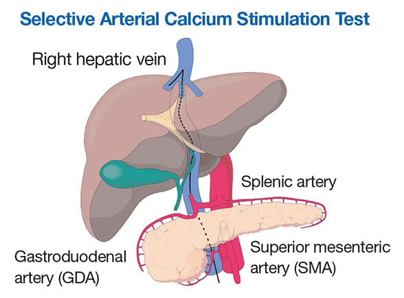 Relationships among the three major arteries and regions of the pancreas supplied