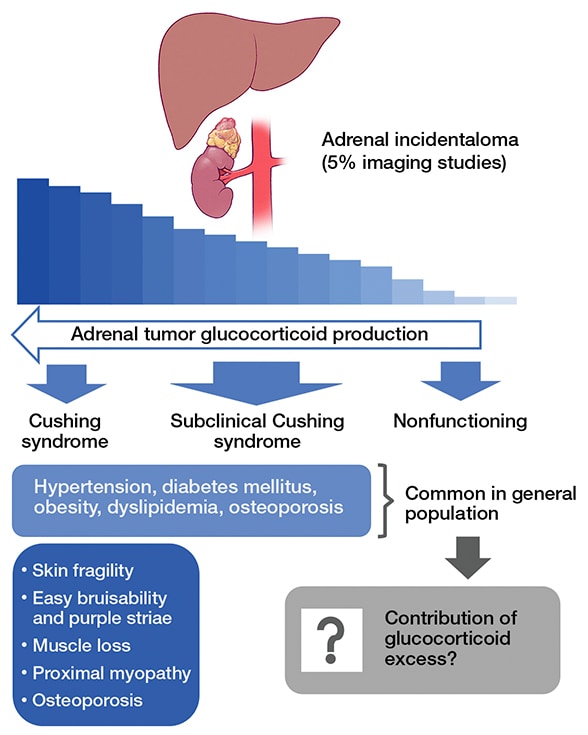 Biochemical and clinical progression related to autonomous glucocorticoid production