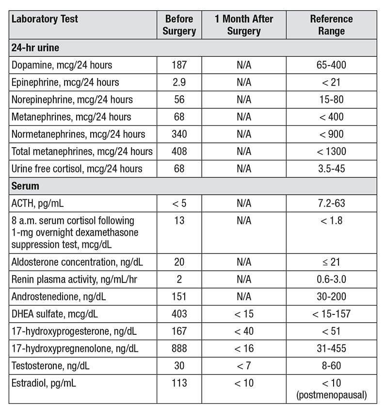 Adrenocortical cancer presenting as postmenopausal bleeding: A case from  the endocrine teaching clinics - Mayo Clinic