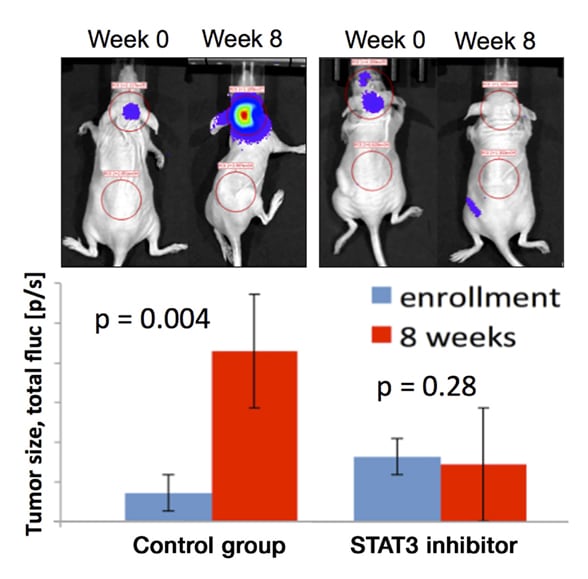 STAT3 inhibitor reduces H3K27M tumor growth