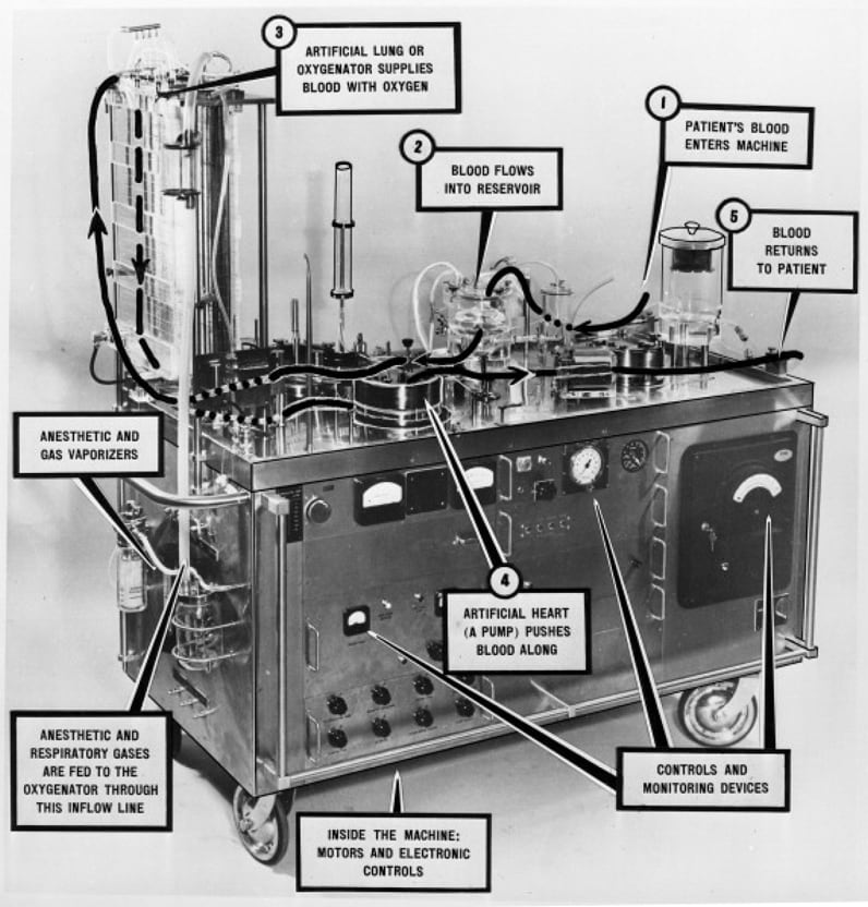 Original Mayo-Gibbon pump-oxygenator