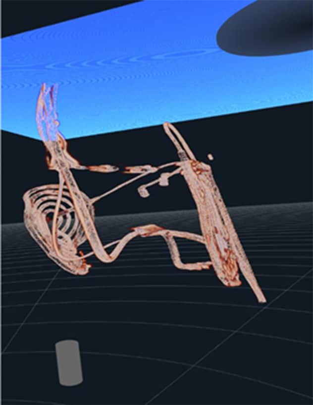 VR clip from patient defibrillation system with cardiac structures stripped away