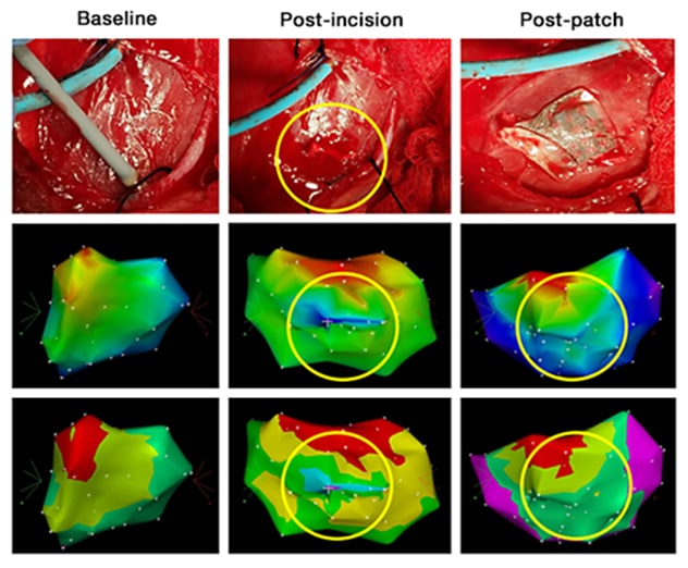Restauración de la activación cardíaca con un parche biológico de nanotubos de carbono