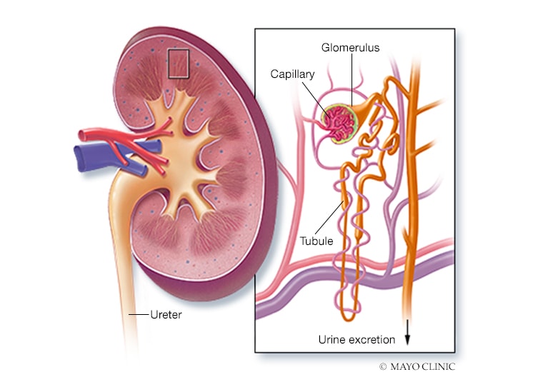 Preventing Glomerulonephritis After Kidney Transplant - Mayo Clinic