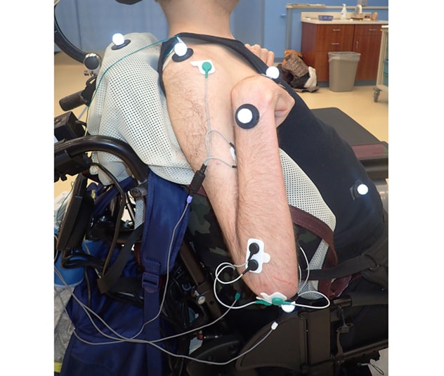 مريض يستعدُّ لإجراء مُخطَّط كهربية العضل (EMG) مع تحليل الحركة