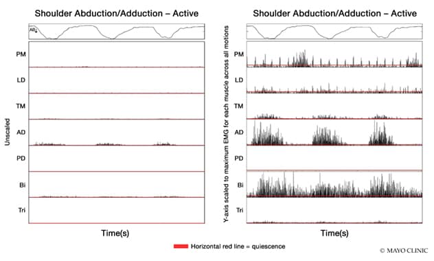 Measurements of muscle activation