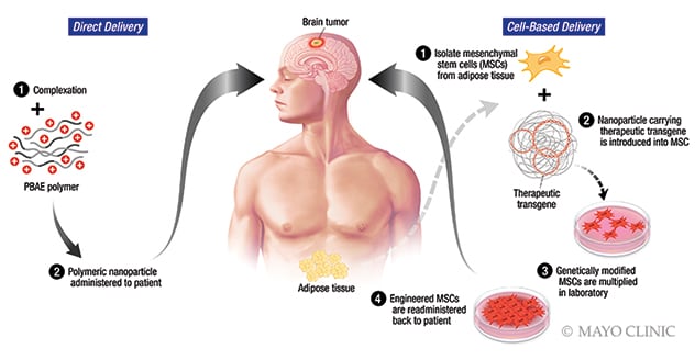 Direct and cell-based delivery of anti-cancer therapy to glioblastomas