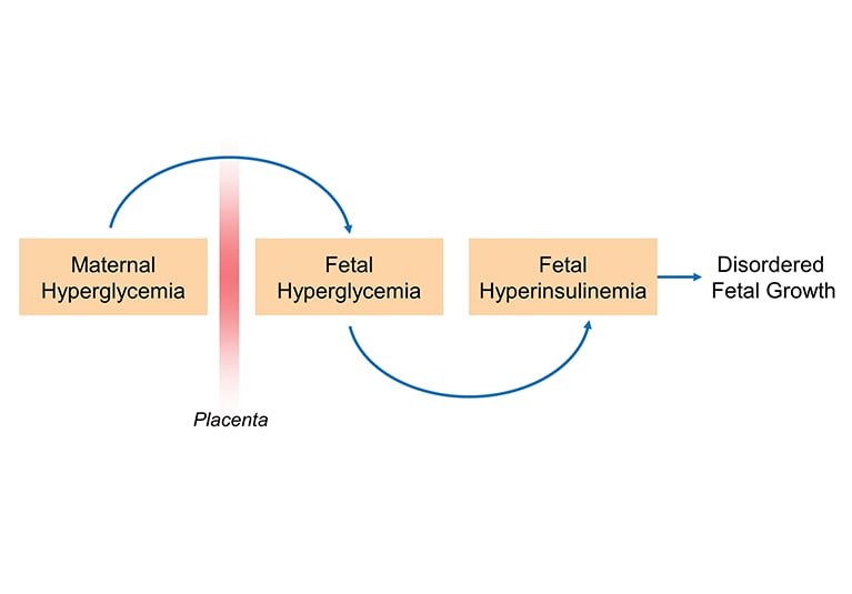 Importance of pre-pregnancy care for women with diabetes: A case